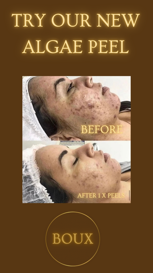 Algae Peel Course of 3